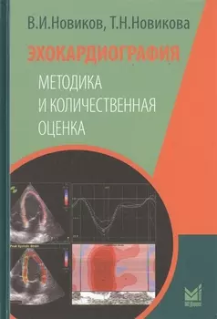 Эхокардиография Методика и количественная оценка