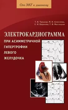 Электрокардиограмма при асимметричной гипертрофии левого желудочка / (мягк) (От ЭКГ к диагнозу). Трешкур Т. и др. (Диля)