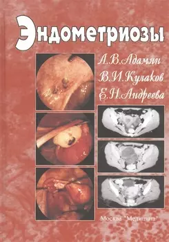 Эндометриозы. Руководство для врачей