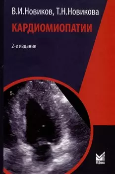 Кардиомиопатии