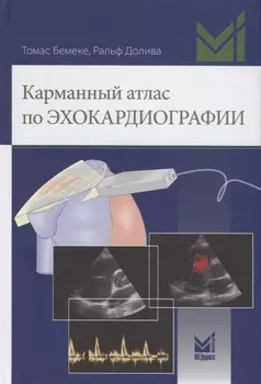 Карманный атлас по эхокардиографии