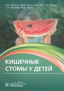 Кишечные стомы у детей