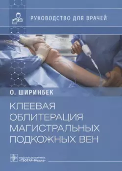 Клеевая облитерация магистральных подкожных вен: руководство для врачей