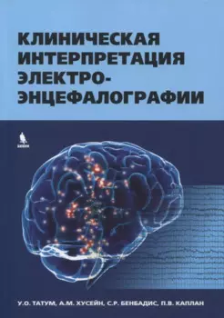 Клиническая интерпретация электроэнцефалографии