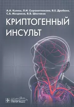 Криптогенный инсульт. Руководство