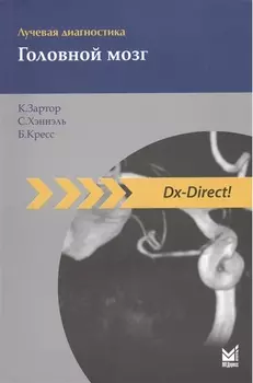 Лучевая диагностика. Головной мозг