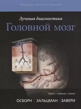 Лучевая диагностика Головной мозг