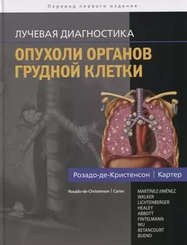 Лучевая диагностика Опухоли органов грудной клетки