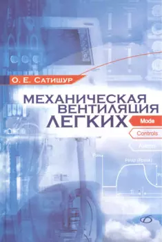 Механическая вентиляция легких