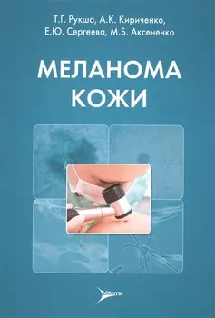 Меланома кожи