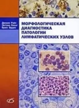 Морфологическая диагн патологии лимфатич узлов