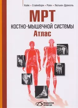 МРТ костно-мышечной системы. Атлас