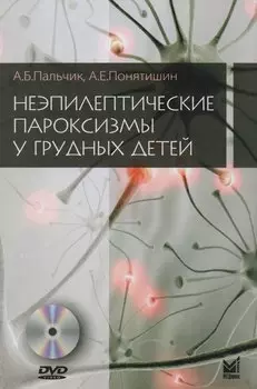 Неэпилептические пароксизмы у грудных детей