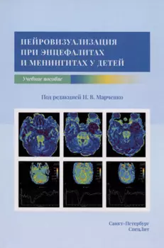 Нейровизуализация при энцефалитах и менингитах у детей. Учебное пособие