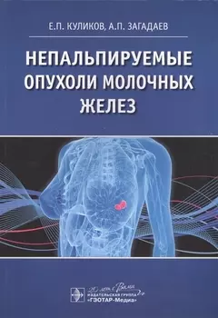 Непальпируемые опухоли молочных желез