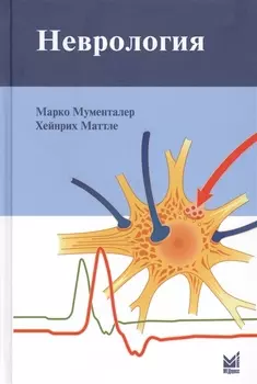 Неврология