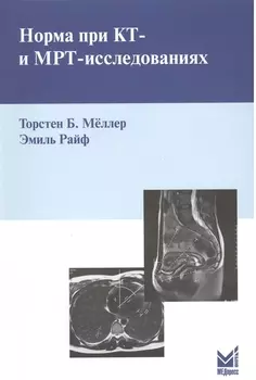 Норма при КТ - и МРТ - исследованиях