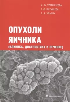 Опухоли яичника (клиника диагностика и лечение)