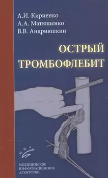 Острый тромбофлебит