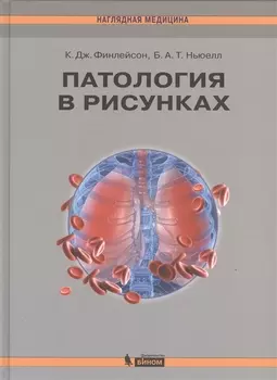 Патология в рисунках