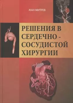 Решение сердечно-сосудистой хирургии