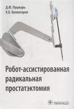 Робот-ассистированная радикальная простатэктомия