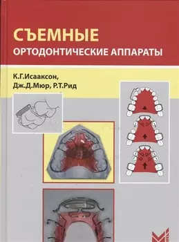 Съемные ортодонтические аппараты