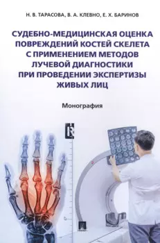 Судебно-медицинская оценка повреждений костей скелета с применением методов лучевой диагностики при проведении экспертизы живых лиц. Монография