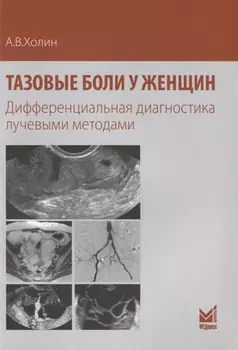 Тазовые боли у женщин Дифференциальная диагностика лучевыми методами (м) Холин