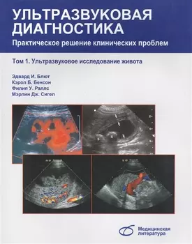 Ультразвуковая диагностика Практическое решение клинических проблем Том1 Ультразвуковое исследование живота