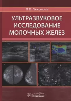 Ультразвуковое исследование молочных желез