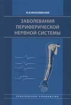 Заболевания периферической нервной системы. Практическое руководство