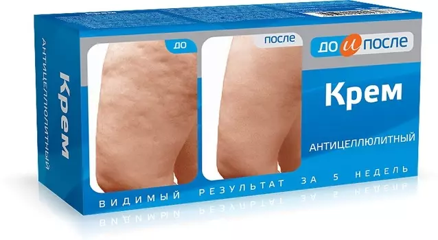 до и после крем антицеллюлитный 100 мл