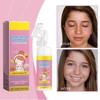 100 мл муссы с койевой кислотой имбиря, очищающее средство для лица, увлажняющее, фиксирующее температуру воды и очищающая пена для лица