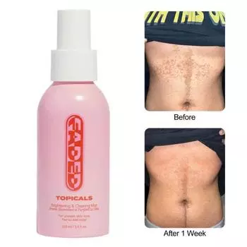 100 мл несмываемый очищающий спрей для мягкого отшелушивания, увлажнения, уменьшения темных пятен, мытья тела, шампуня, личного очищающего средства для пожилых людей, страдающих недержанием мочи 100ML