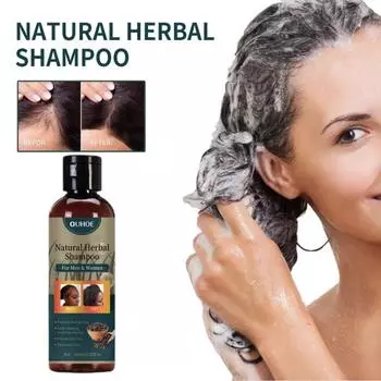 100 мл шампунь для волос, питательный уход за кожей головы, безопасные ингредиенты, против выпадения волос, шампунь для роста волос, продукты для волос 100ML