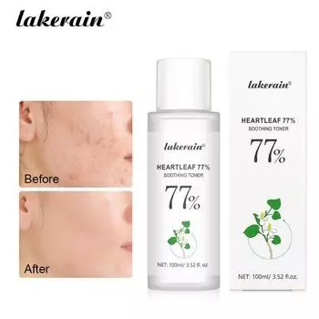 100 мл спрей для лица, освежающий, увлажняющий, успокаивающий, увлажняющий тоник, лосьон для кожи 100ml