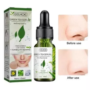 10 мл эссенция для омоложения кожи, легко впитывается, косметический инструмент, глубокое проникновение, практичная эссенция для лица, лосьон, жидкие аксессуары 10ML