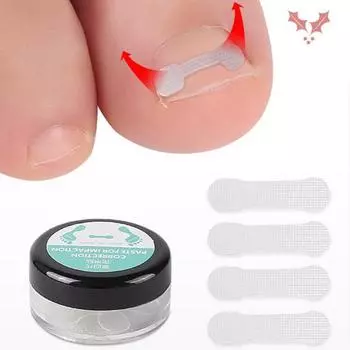 10 шт./кор. наклейки для коррекции ногтей, удобные, удобные, быстросъемные, модные, эффективные, оздоровительные инструменты, смоляная паста для коррекции поврежденных ногтей на ногах для дома