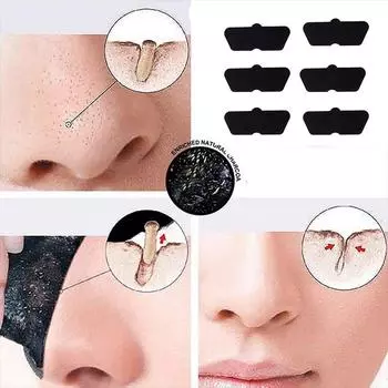 10 шт. Маска для удаления черных точек на носу, полоски для носа, отшелушивающая наклейка для лица, угревая сыпь, белые угри, очищающая маска для пор