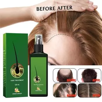 120 мл густая жидкость для волос, крепкие и жесткие волосы, питательная для роста корней волос, густая питательная жидкость для массажа кожи головы One Size