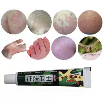 15 г травяная мазь антибактериальный крем для снятия зуда и проблем с кожей