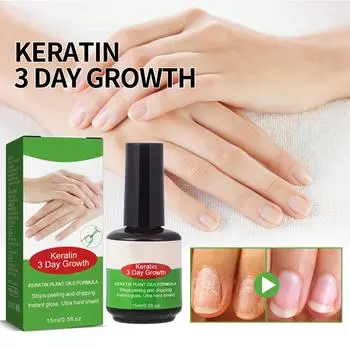 15 мл Средство по уходу за ногтями, восстановление серых ногтей, смягчение, утолщение, осветление, средство по уходу за ногтями One Size зелёный