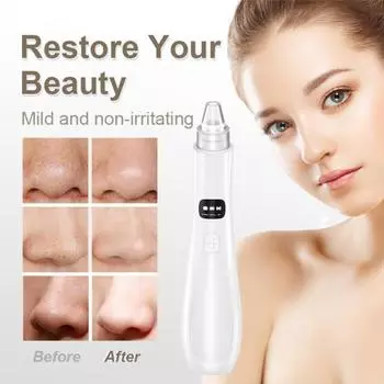 1 комплект, очиститель от прыщей, глубокое очищение, средство для удаления черных точек, USB перезаряжаемый электрический инструмент для удаления прыщей для женщин белый