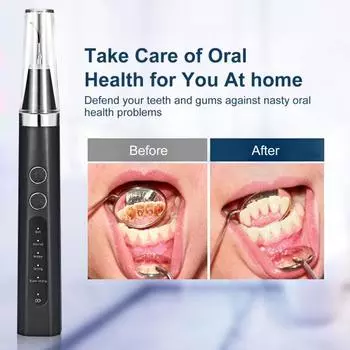 1 комплект точного удаления зубного камня, компактный высокочастотный бытовой аппарат для удаления зубного камня, ультразвуковой скалер чёрный