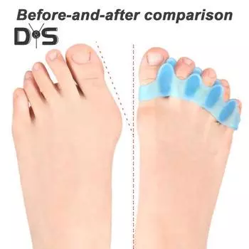 1 пара гелевых прокладок для пальцев ног для женщин и мужчин, гель для облегчения боли в ногах, корректор бурсита, разделители пальцев для перекрывающихся пальцев бежевый