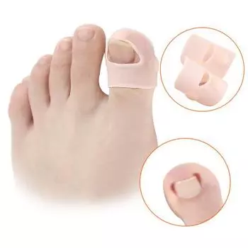 1 пара полезных, удобных и удобных средств для лечения вросших ногтей, облегчения воспаления, коррекции ногтей для дома