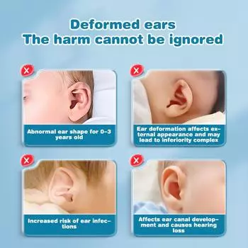 1 рулон 4 см 0,5 м детский корректор ушных раковин коррекция торчащих ушей младенцев силиконовый детский корректор эстетических ушей наклейка