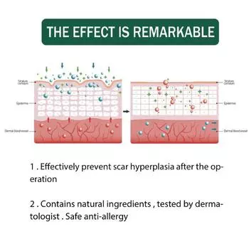 1 рулон силиконовых пластырей для шрамов, 4 см x 150 см, невидимая самоклеящаяся лента для покрытия шрамов, многоразовые и эффективные полоски для ухода за кожей