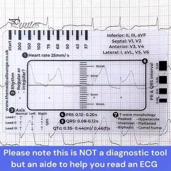 1 шт./1 комплект ЭКГ линейка с 7 шагами пластиковый штангенциркуль для измерения электрокардиограммы измерительный инструмент прозрачное справочное руководство по интерпретации ЭКГ измерительная линейка A